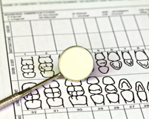 Periodontal Chart