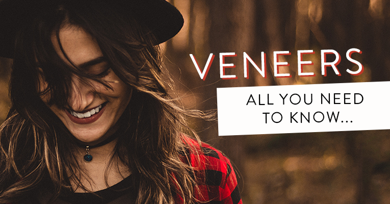 all you need to know about veneers